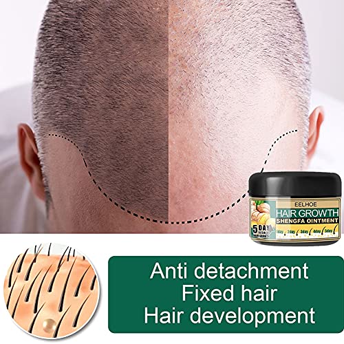 Ginger hair Growth mast-Ginger Germinal regenerator - Serum za ponovni rast kose - hidratantna masaža vlasišta